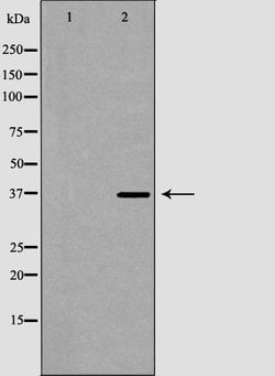 Invitrogen CD42a Polyclonal Antibody 100 &mu;L | Buy Online | Invitrogen&trade; | Fisher Scientific