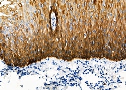 Invitrogen PSMC6 Polyclonal Antibody 100 &mu;L; Unconjugated:Antibodies,