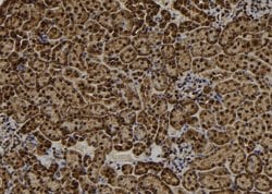 Invitrogen RAD18 Polyclonal Antibody 100 &mu;L; Unconjugated:Antibodies,