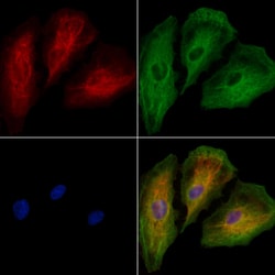AP2A2 Polyclonal Antibody:Antibodies, Polyclonal