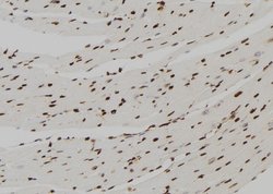 Invitrogen FBP1 Polyclonal Antibody 100 &mu;L; Unconjugated:Antibodies,