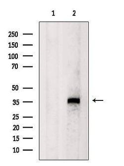 Invitrogen FBP1 Polyclonal Antibody 100 &mu;L; Unconjugated:Antibodies,