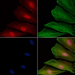 Invitrogen HUS1 Polyclonal Antibody 100 &mu;L; Unconjugated:Antibodies,