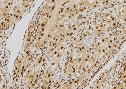 Invitrogen HEC1 Polyclonal Antibody 100 &mu;L; Unconjugated:Antibodies,