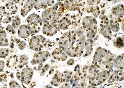 Invitrogen HEC1 Polyclonal Antibody 100 &mu;L; Unconjugated:Antibodies,