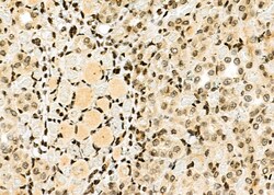 Invitrogen HEC1 Polyclonal Antibody 100 &mu;L; Unconjugated:Antibodies,