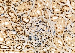 Invitrogen HEC1 Polyclonal Antibody 100 &mu;L; Unconjugated:Antibodies,
