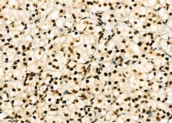 Invitrogen HEC1 Polyclonal Antibody 100 &mu;L; Unconjugated:Antibodies,