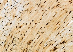 Invitrogen HEC1 Polyclonal Antibody 100 &mu;L; Unconjugated:Antibodies,