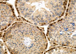 Invitrogen HEC1 Polyclonal Antibody 100 &mu;L; Unconjugated:Antibodies,
