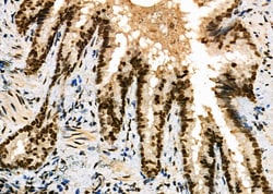 Invitrogen HEC1 Polyclonal Antibody 100 &mu;L; Unconjugated:Antibodies,