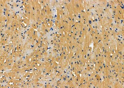 Invitrogen PCCB Polyclonal Antibody 100 &mu;L; Unconjugated:Antibodies,