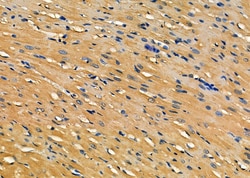 Invitrogen PCCB Polyclonal Antibody 100 &mu;L; Unconjugated:Antibodies,