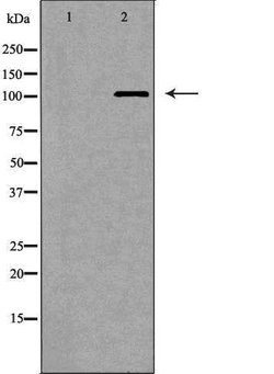 Invitrogen MERTK Polyclonal Antibody 100 &mu;L; Unconjugated:Antibodies,