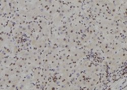 Invitrogen APRT Polyclonal Antibody 100 &mu;L | Buy Online | Invitrogen&trade; | Fisher Scientific
