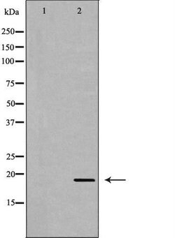 Invitrogen APRT Polyclonal Antibody 100 &mu;L | Buy Online | Invitrogen&trade; | Fisher Scientific