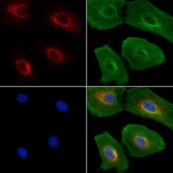 Invitrogen Lamin B Receptor Polyclonal Antibody 100 &mu;L; Unconjugated:Antibodies,