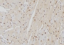 Invitrogen Lamin B Receptor Polyclonal Antibody 100 &mu;L; Unconjugated:Antibodies,