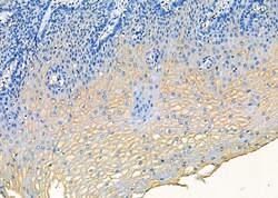 Invitrogen MTH1 Polyclonal Antibody 100 &mu;L; Unconjugated:Antibodies,