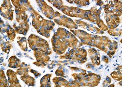Invitrogen MTH1 Polyclonal Antibody 100 &mu;L; Unconjugated:Antibodies,