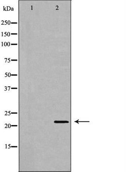 Invitrogen MTH1 Polyclonal Antibody 100 &mu;L; Unconjugated:Antibodies,