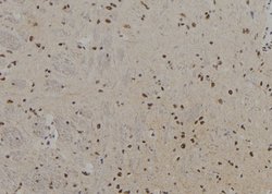 Invitrogen PFKM Polyclonal Antibody 100 &mu;L; Unconjugated:Antibodies,