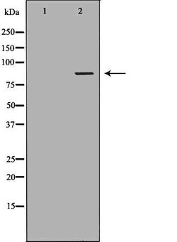Invitrogen PFKM Polyclonal Antibody 100 &mu;L; Unconjugated:Antibodies,