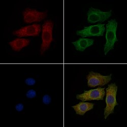 S100A11 Polyclonal Antibody:Antibodies, Polyclonal