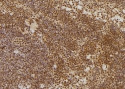 S100A11 Polyclonal Antibody:Antibodies, Polyclonal