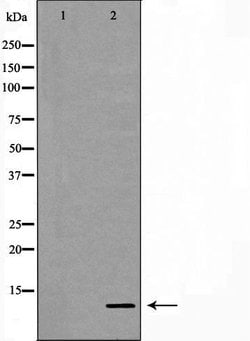 S100A11 Polyclonal Antibody:Antibodies, Polyclonal