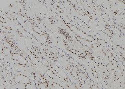 Invitrogen UBE2C Polyclonal Antibody 100 &mu;L; Unconjugated:Antibodies,