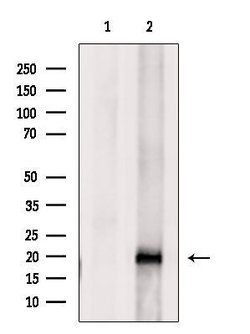 Invitrogen UBE2C Polyclonal Antibody 100 &mu;L; Unconjugated:Antibodies,