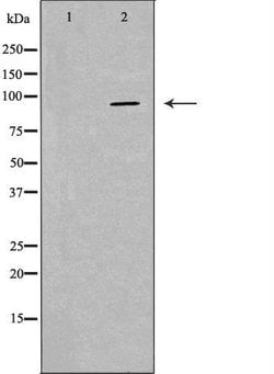 Invitrogen PKP2 Polyclonal Antibody 100 &mu;L; Unconjugated:Antibodies,