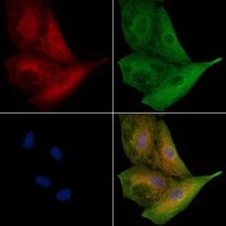 Invitrogen UGT1A4 Polyclonal Antibody 100 &mu;L; Unconjugated:Antibodies,