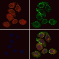 Invitrogen KLC1 Polyclonal Antibody 100 &mu;L; Unconjugated:Antibodies,