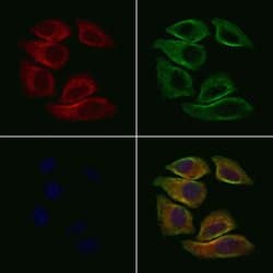 Invitrogen PNMT Polyclonal Antibody 100 &mu;L; Unconjugated:Antibodies,
