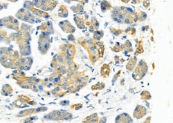 Invitrogen Asparagine Synthetase Polyclonal Antibody 100 &mu;L; Unconjugated:Antibodies,
