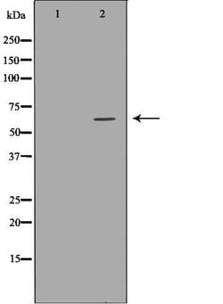 Invitrogen Asparagine Synthetase Polyclonal Antibody 100 &mu;L; Unconjugated:Antibodies,