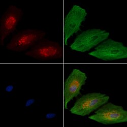 Invitrogen WNK3 Polyclonal Antibody 100 &mu;L; Unconjugated:Antibodies,
