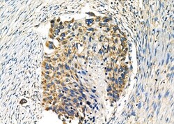 Invitrogen WNK3 Polyclonal Antibody 100 &mu;L; Unconjugated:Antibodies,