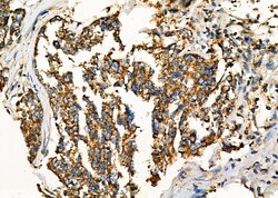 Invitrogen WNK3 Polyclonal Antibody 100 &mu;L; Unconjugated:Antibodies,