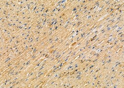 Invitrogen WNK3 Polyclonal Antibody 100 &mu;L; Unconjugated:Antibodies,