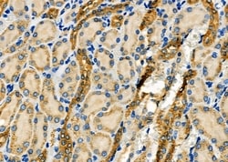 Invitrogen WNK3 Polyclonal Antibody 100 &mu;L; Unconjugated:Antibodies,
