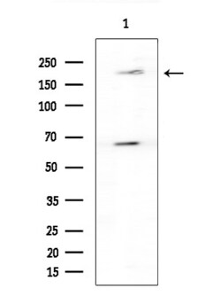 Invitrogen WNK3 Polyclonal Antibody 100 &mu;L; Unconjugated:Antibodies,