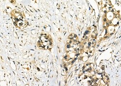 Invitrogen RABL2A Polyclonal Antibody 100 &mu;L; Unconjugated:Antibodies,