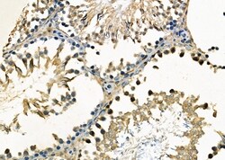 Invitrogen RABL2A Polyclonal Antibody 100 &mu;L; Unconjugated:Antibodies,