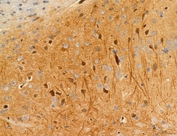 Invitrogen MLKL Polyclonal Antibody 100 &mu;L | Buy Online | Invitrogen&trade; | Fisher Scientific