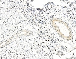 Invitrogen MLKL Polyclonal Antibody 100 &mu;L | Buy Online | Invitrogen&trade; | Fisher Scientific