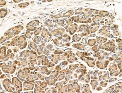 Invitrogen MLKL Polyclonal Antibody 100 &mu;L | Buy Online | Invitrogen&trade; | Fisher Scientific