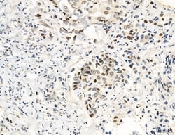 Invitrogen MLKL Polyclonal Antibody 100 &mu;L | Buy Online | Invitrogen&trade; | Fisher Scientific